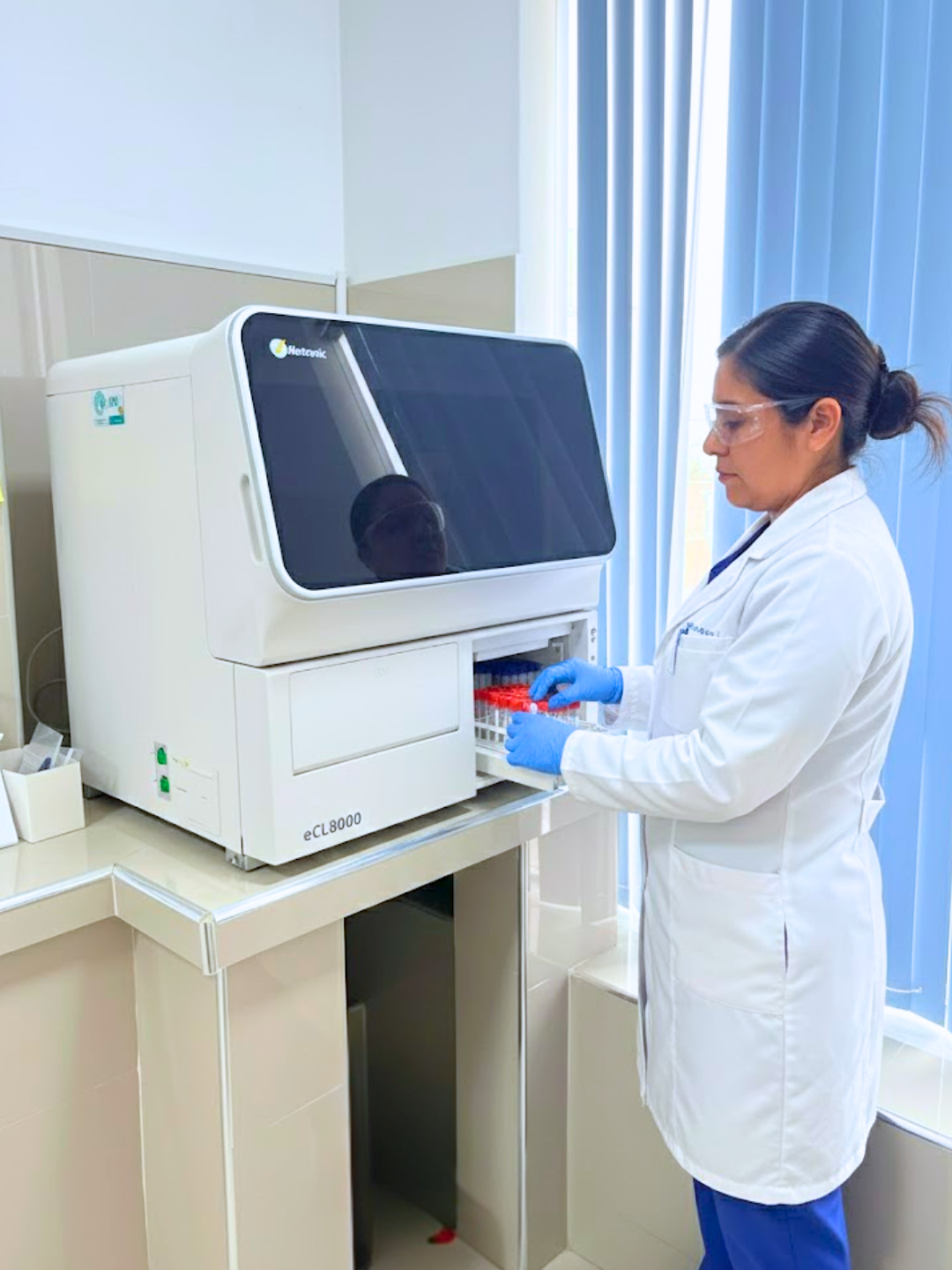 Glucosa en sangre laboratorio Buena Salud